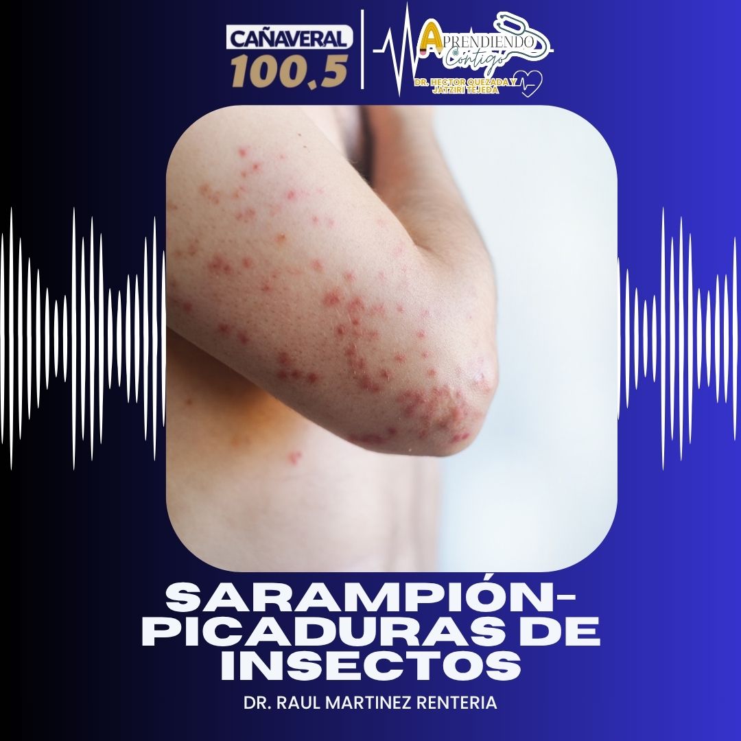 SARAMPIÓN-PICADURAS DE INSECTOS – 30 de marzo 2026