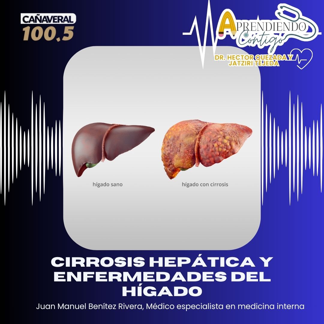 Cirrosis hepática y enfermedades del hígado -24 de agosto 2026